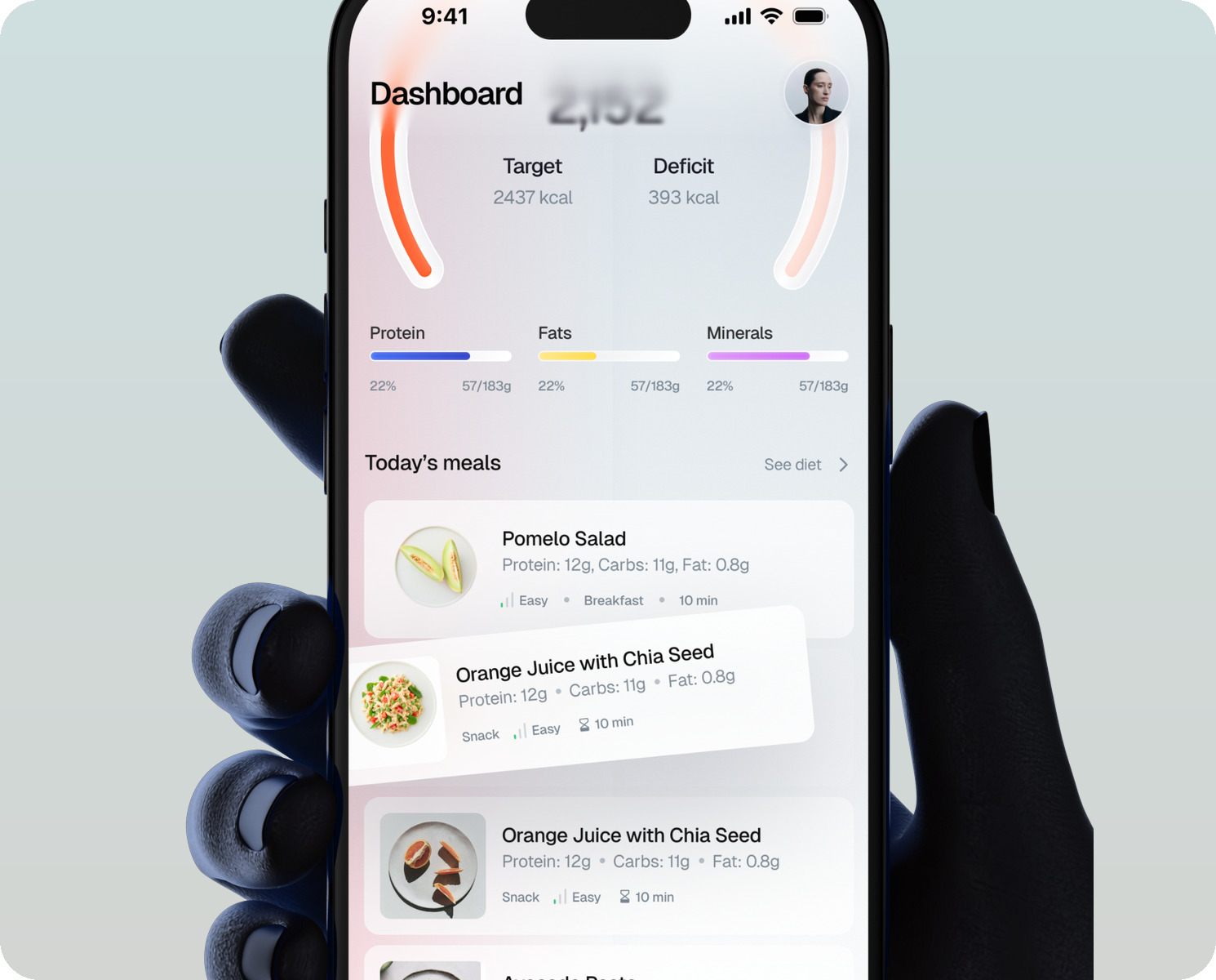 Hand holding an iPhone showing the Treat Dashboard with the calorie ring, macro bars and today's meals